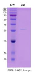 SDS-PAGE (NCR2-5337H).jpg